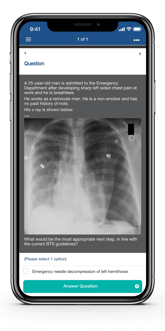 BMJ OnExamination mobile app question screen with clinical image